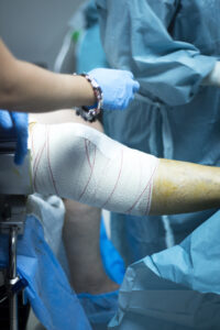 Total Knee Replacement