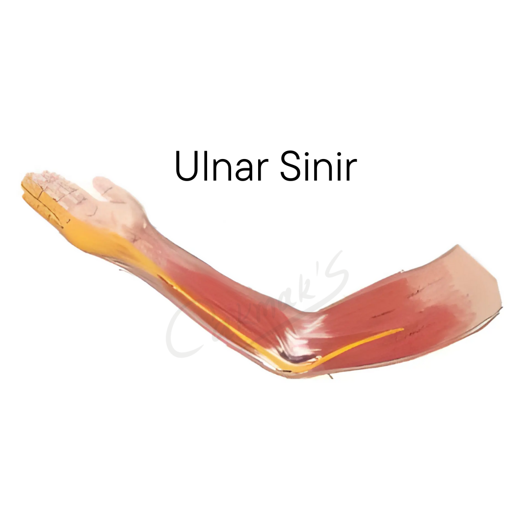 Ulnar Sinir Sıkışması