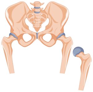 Patella Çıkığı Ameliyatı Olanlar